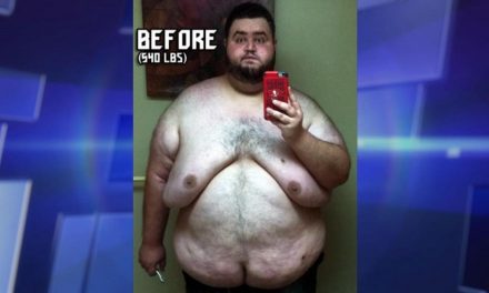 Man’s Incredible Weight Loss And Overcoming Food Addiction