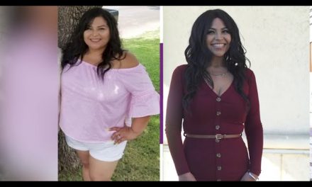 Considering Weight Loss Surgery