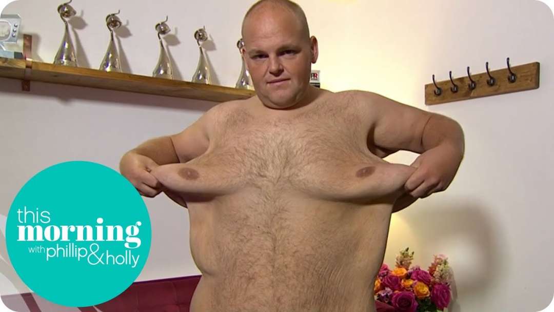 Dibsy Needs Excess Skin Removed After Incredible 19 Stone Weight Loss | This Morning