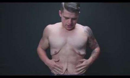 Man Strips To Show You Loose Skin After Massive Weight Loss