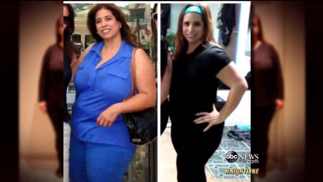 Americans Head To Mexico For Weight-Loss ‘Balloon Pill’