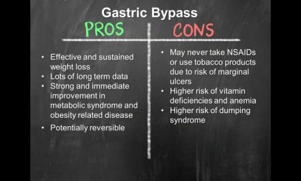 Types Of Weight Loss Surgery | OSF Saint Francis Medical Center