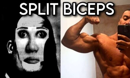 BICEP GENETICS