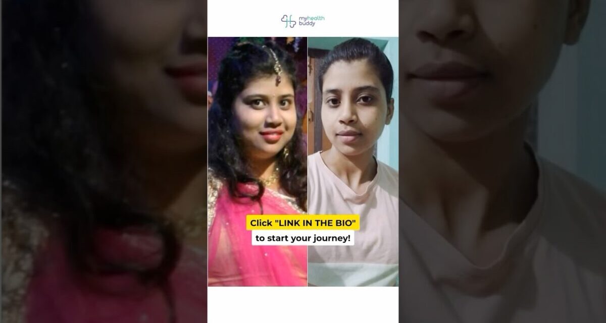 20 Kgs Weight Loss + Face Fat Loss (PCOD Issue)