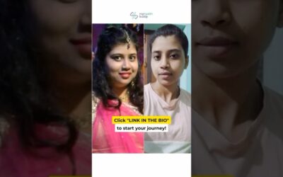 20 Kgs Weight Loss + Face Fat Loss (PCOD Issue)