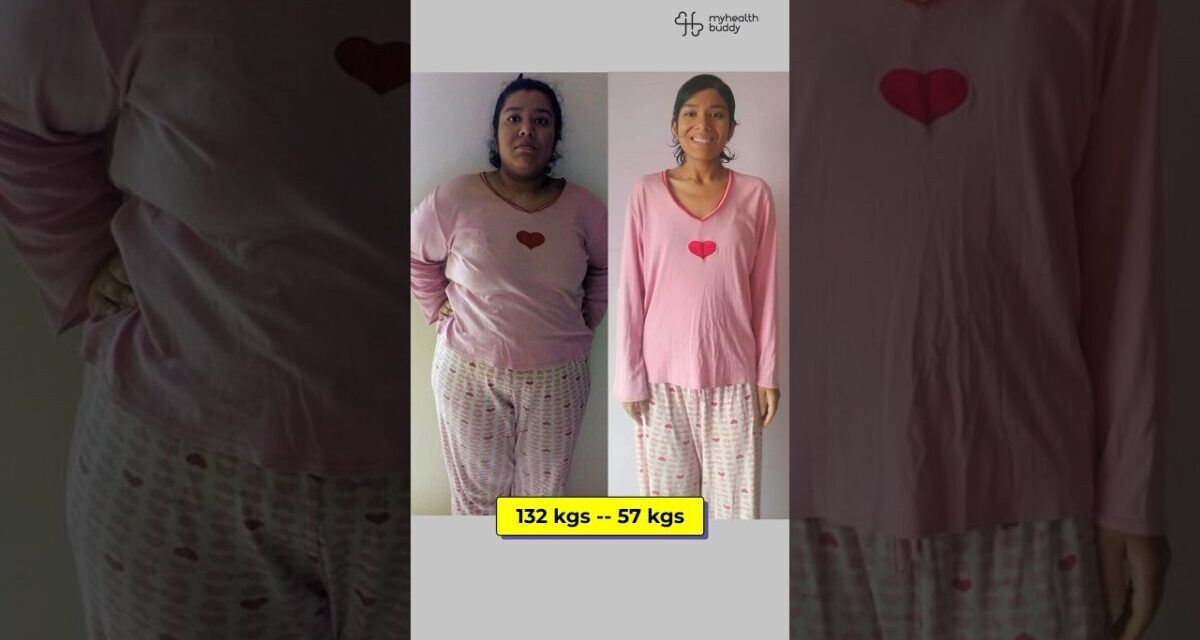 75 Kgs Full Body Weight Loss (😳 132 Kgs – Starting Weight)