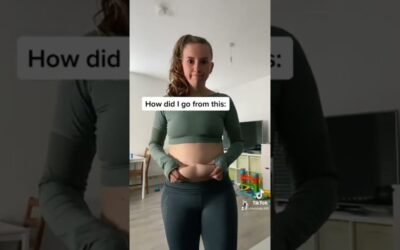 Extreme Weightloss Transformation!!😱 #fatloss #weightloss