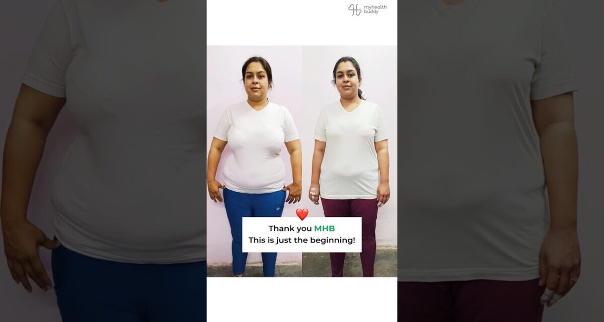 13 Kgs Weight Loss And Belly Fat Gone Despite Endometriosis | MyHealthBuddy