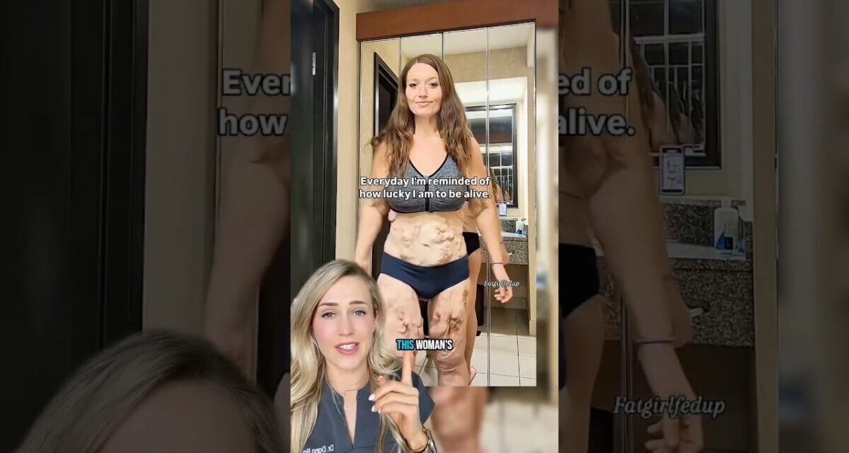 Doctor Reacts: Weight Loss Tranformation
