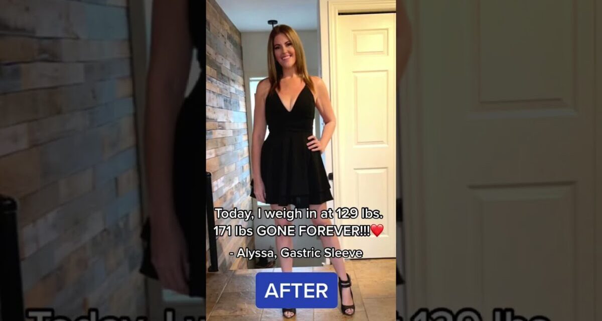 171 Lbs Gone Forever!! | My Weight Loss Surgery Journey