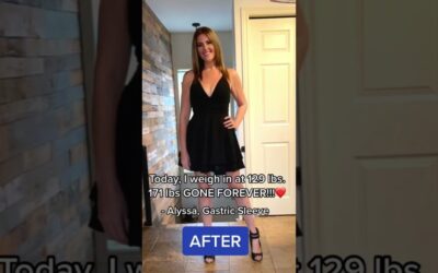 171 Lbs Gone Forever!! | My Weight Loss Surgery Journey