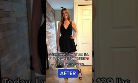 171 Lbs Gone Forever!! | My Weight Loss Surgery Journey