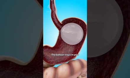 How A Gastric Balloon Helps With Weight Loss 😮 # Shorts #viralvideo – Creativelearning3d