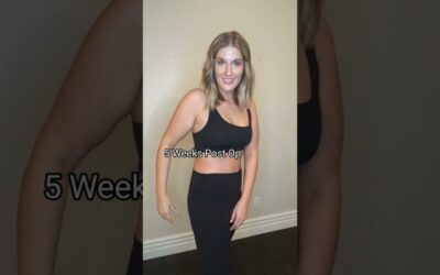 Skin Removal After 100+ Pound Weight Loss