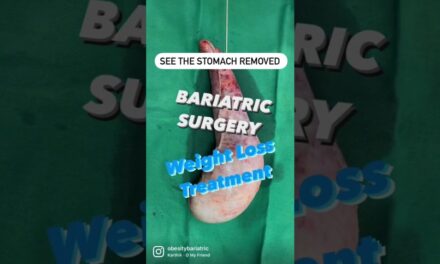 Weight Loss Operation In Surat – Bariatric Surgery In India