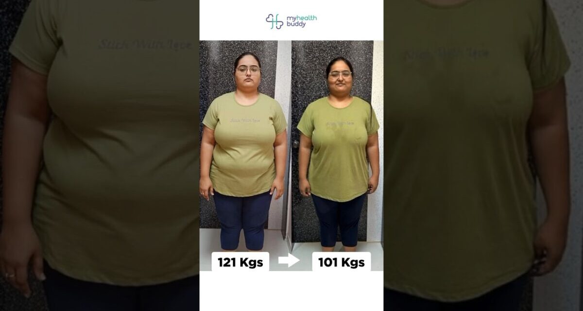 20 Kgs Weight Loss | My CALORIE DEFICIT DIET PLAN