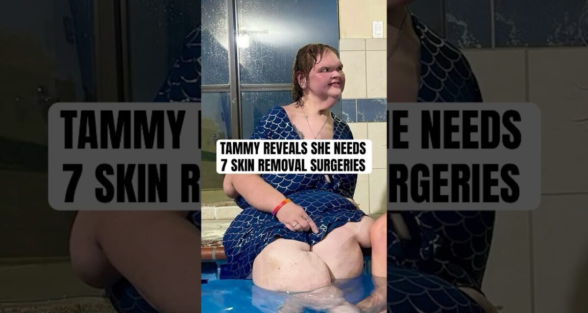 Tammy Slaton Reveals Plans For Skin Removal Surgery After 500lb Weight Loss  #shorts #1000lbsisters