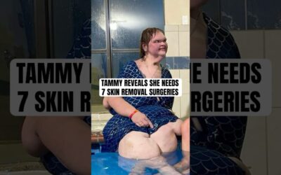 Tammy Slaton Reveals Plans For Skin Removal Surgery After 500lb Weight Loss  #shorts #1000lbsisters