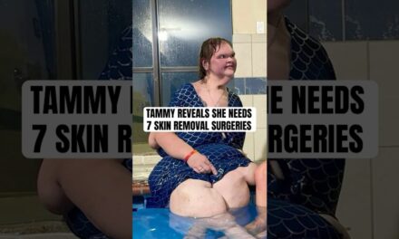 Tammy Slaton Reveals Plans For Skin Removal Surgery After 500lb Weight Loss  #shorts #1000lbsisters