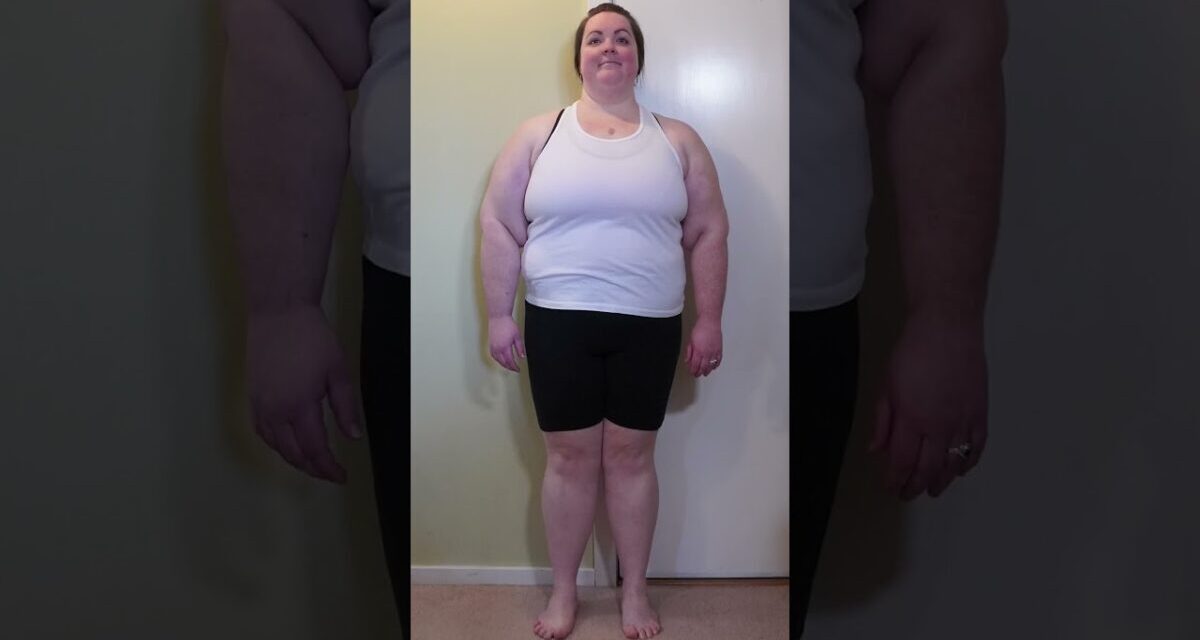 My 121 Lbs. 1 Year Weight Loss Transformation #health #weightloss #carnivore