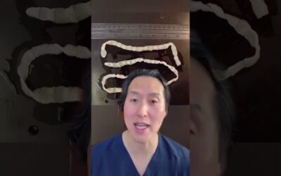 Weight Loss Due To Tapeworms?!?! It’s True #shorts